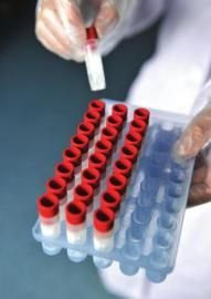 四川精子庫報告:捐精合格率不足20%